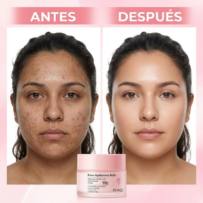 Elimina las Arrugas Y Resequedad - Rejuvenece Desde El Día 1